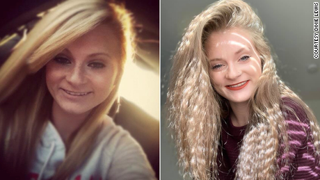 Dixie Lewis is shown here when she was 17 years old (left) and now (right).