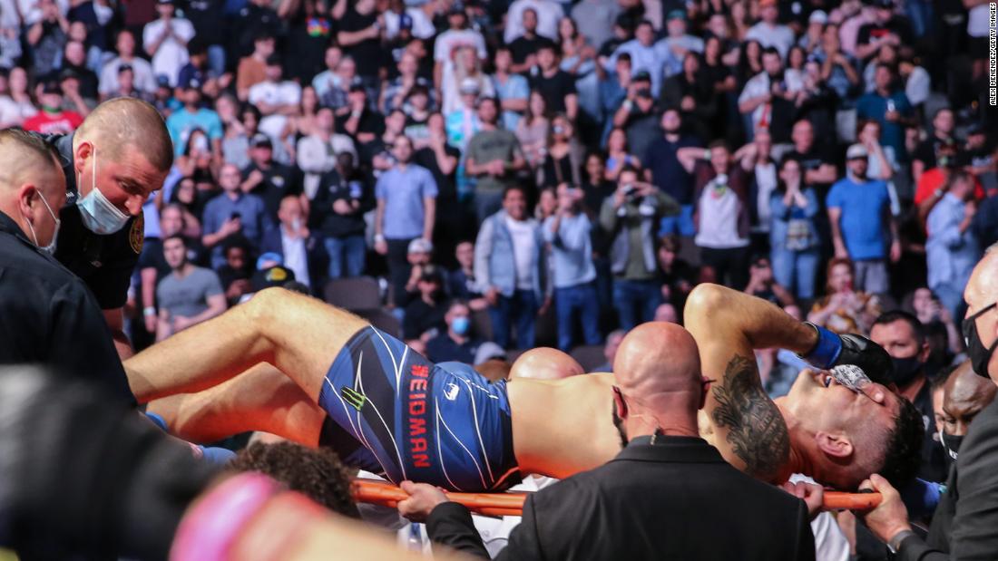 Former UFC champion Chris Weidman has surgery after suffering 'freak' leg break