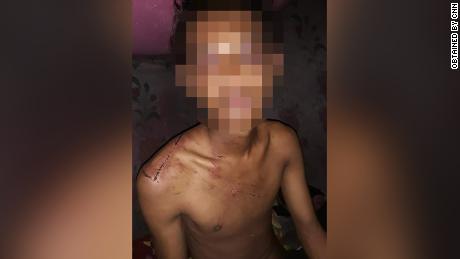 El joven de 19 años dijo que fue golpeado repetidamente mientras estaba bajo detención militar.