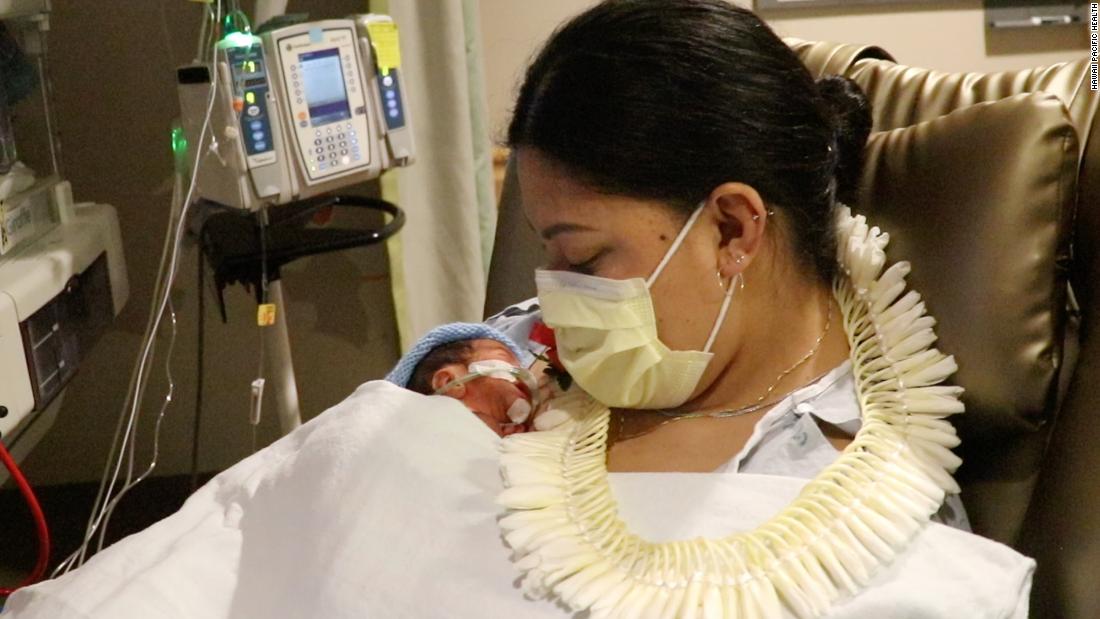 A woman gave birth prematurely on a flight to Hawaii. Luckily, 3 NICU nurses and a doctor were on board to help