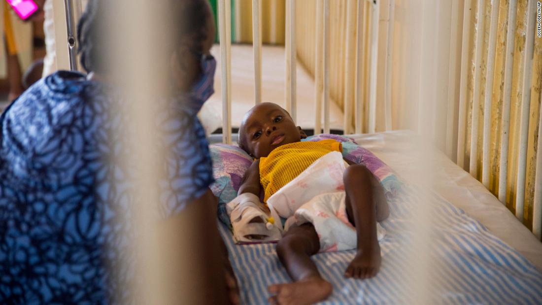 Child malnutrition is spiking in Haiti amid pandemic, says UNICEF