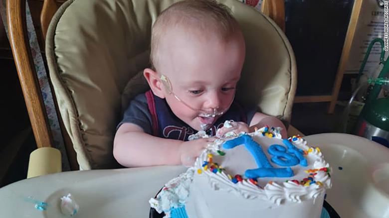 The world’s most premature baby has celebrated his first birthday after beating 0% odds of surviving