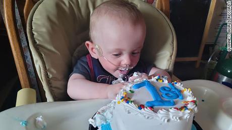 The world&#39;s most premature baby has celebrated his first birthday after beating 0% odds of surviving