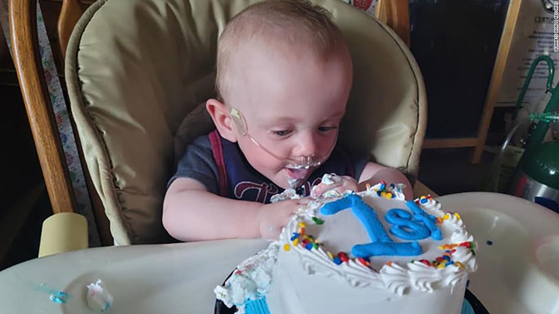 The world's most premature baby has celebrated his first birthday after beating 0% odds of surviving