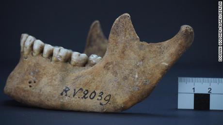 The jawbone of the man who was buried in Rinnukalns, Latvia, around 5,000 years ago.