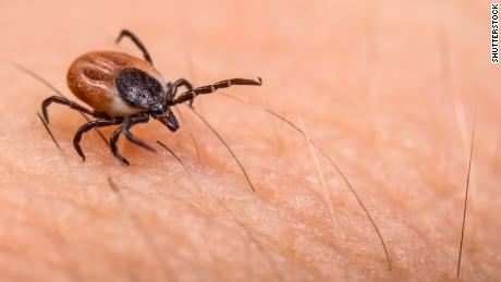 Tick season is here. Here&#39;s what you need to know