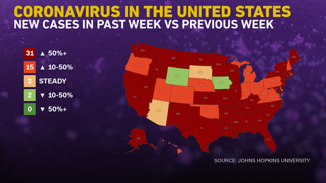 Covid-19 cases are surging in 46 states. In one hot spot, hospitalized patients are younger than ever, doctor says