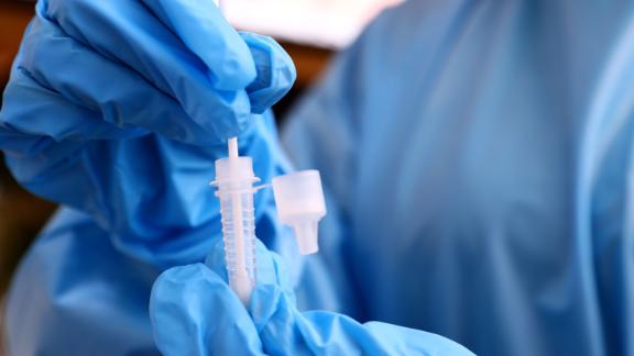 LOS ANGELES, CALIFORNIA - JULY 14: A registered nurse stirs a nasal swab in testing solution after administering a COVID-19 test at Sameday Testing on July 14, 2021 in Los Angeles, California. COVID-19 cases are on the rise in most states as the highly transmissible Delta variant has become the dominant strain in the United States. (Photo by Mario Tama/Getty Images)