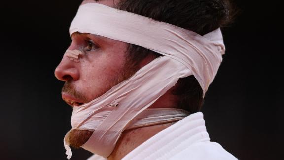 Spanish judoka Alberto Gaitero Martin is bandaged during his bout against Ukraine's Georgii Zantaraia on July 25.