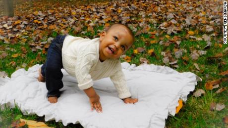 One-year-old Blake Vince Payne, after surgery for brain cancer.