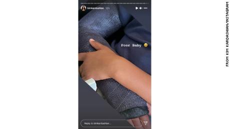 Kardashian's Instagram story showed Saint's arm in a plaster cast.