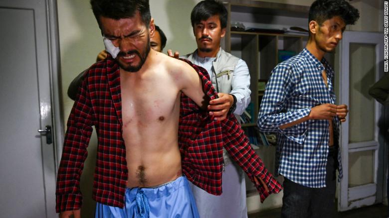 ‘I thought this was the end of my life:’ Afghan journalists describe savage beatings by Taliban