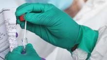 A Healthcare Worker seals a coronavirus test sample.
