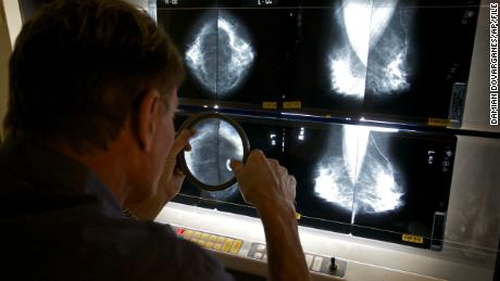 Doctors Look At Advanced Cancer Cases In Wake Of Pandemic-Delayed Screening And Treatment
