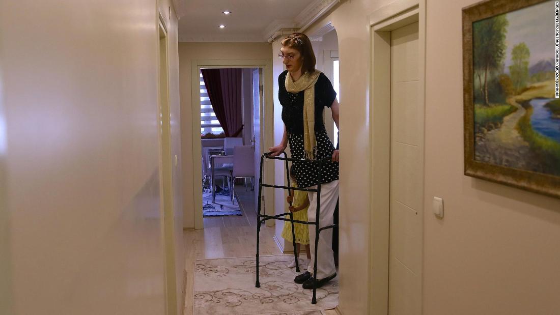 World S Tallest Woman Is Rumeysa Gelgi A 24 Year Old From Turkey Cnn