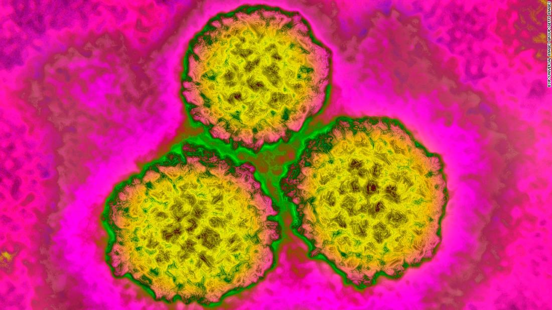 HPV vaccine reduced cervical cancer rates by 87% in women UK study finds – CNN