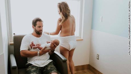 &#39;Life after birth&#39;: Intimate photos show postpartum journeys of celebrities and mothers everywhere