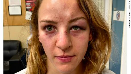 Margaux Pinot posted an image of her injuries on social media earlier this week. 
