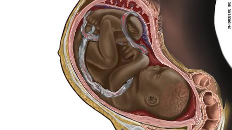 An image of a Black fetus in a womb by the illustrator Chidiebere Ibe captured the attention of the internet recently, with many people noting that they had never seen dark skin in these types of images.