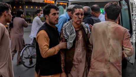 A person wounded in the ISIS bombing attack outside Kabul airport on August 26, 2021. 