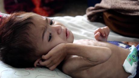 She's nearly 3 but as small as an infant. This is the face of Afghanistan's hunger crisis