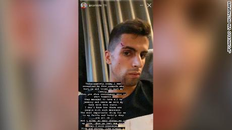 João Cancelo: Manchester City defender assaulted during burglary at his home