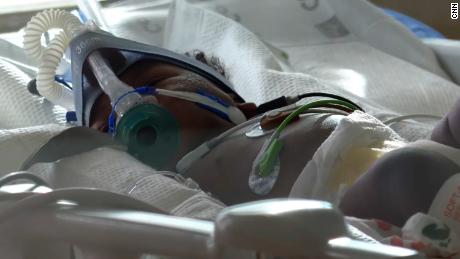 4-month-old Graysen Perry's mother said she's worried her baby might have to be intubated.