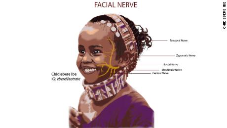 Chidiebere Ibe pradėjo kurti medicinines iliustracijas 2020 m., kuriose vaizduojamos įvairios sąlygos ir anatomija, viskas juoda.
