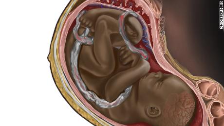 The creator of the viral image of the black fetus will have his illustrations published in a book