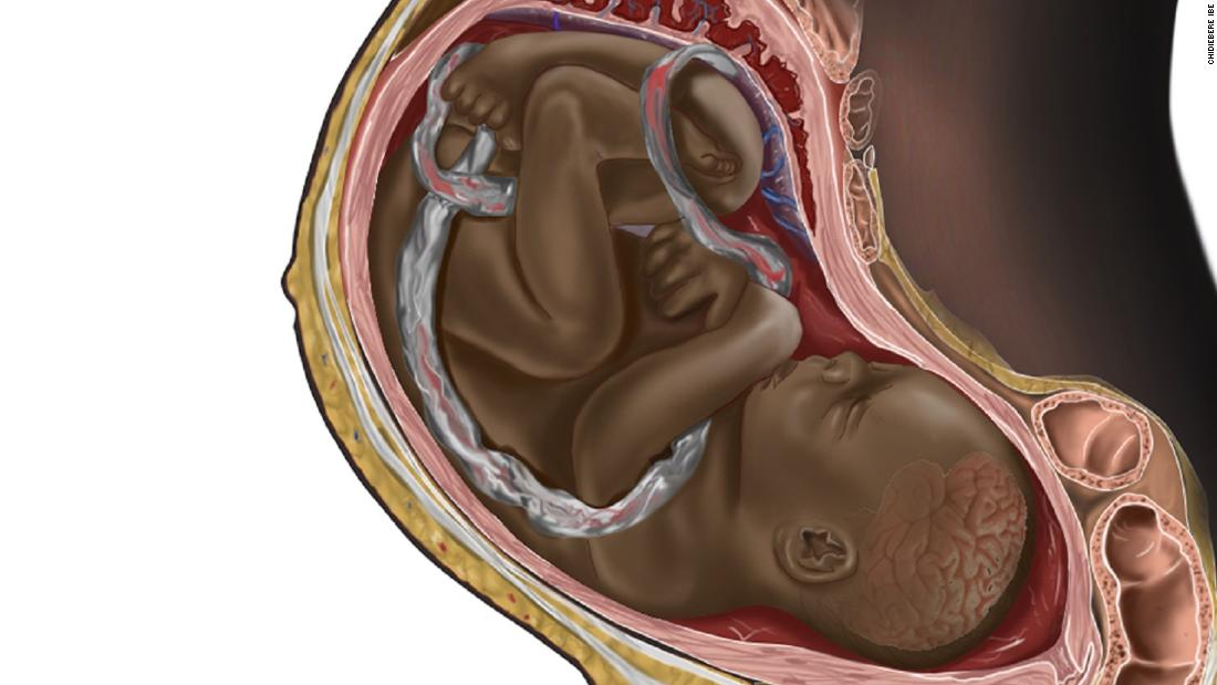 This image by Nigerian illustrator Chidiebere Ibe of a Black fetus in the womb went viral last December. Still a medical student, Ibe will now have some of his illustrations published in a clinical handbook.