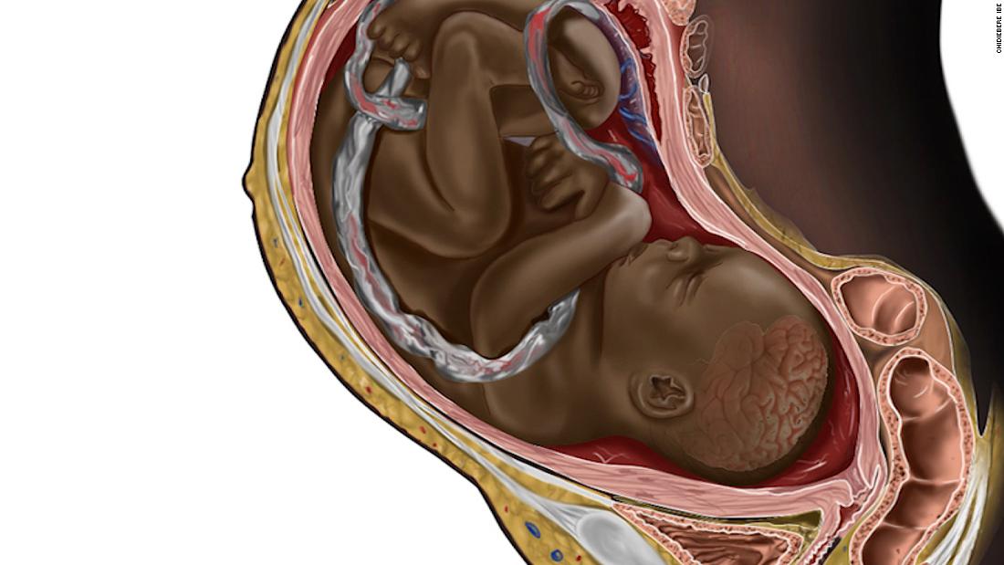 Artist behind viral image of Black fetus speaks out