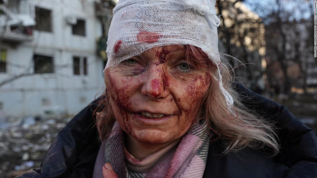 A wounded woman is seen after a reported airstrike at an apartment complex outside of Kharkiv, Ukraine, on February 24.