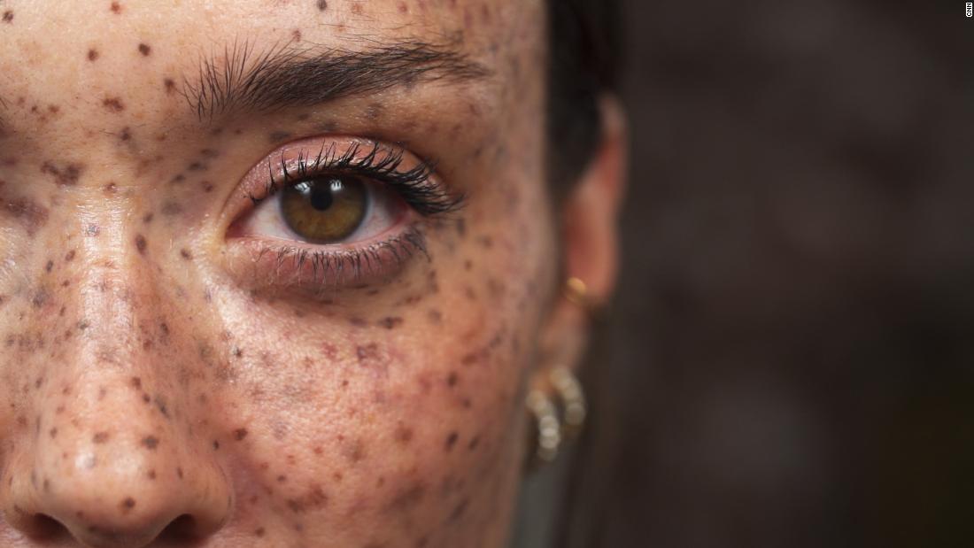 220228152023-as-we-are-maeva-freckles-card-super-tease.jpg