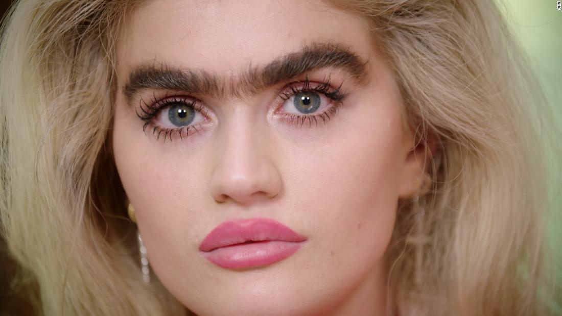 Video: She is bullied for her eyebrows. Who decides what's beautiful?