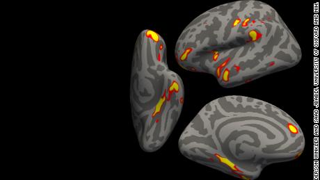 Study Links Even Mild Covid-19 To Changes In The Brain - CNN