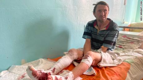 Igor Rubtsov says he was struck by shelling while feeding animals on the street where he lives.