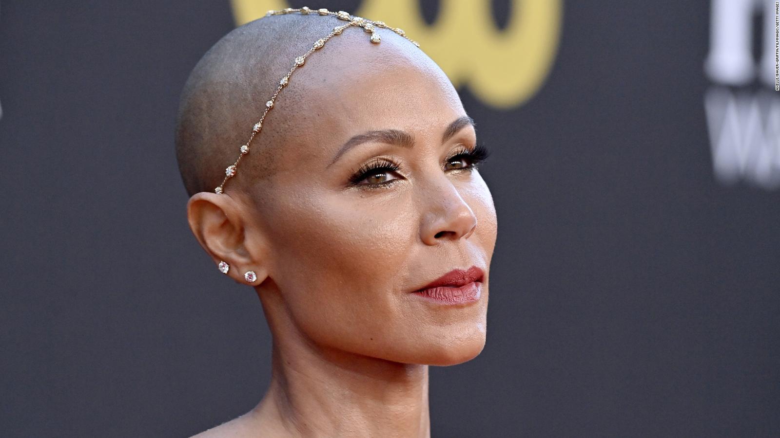 Jada Pinkett Smith: Oscars controversy shines a light on actress's  'struggle' with alopecia - CNN Style