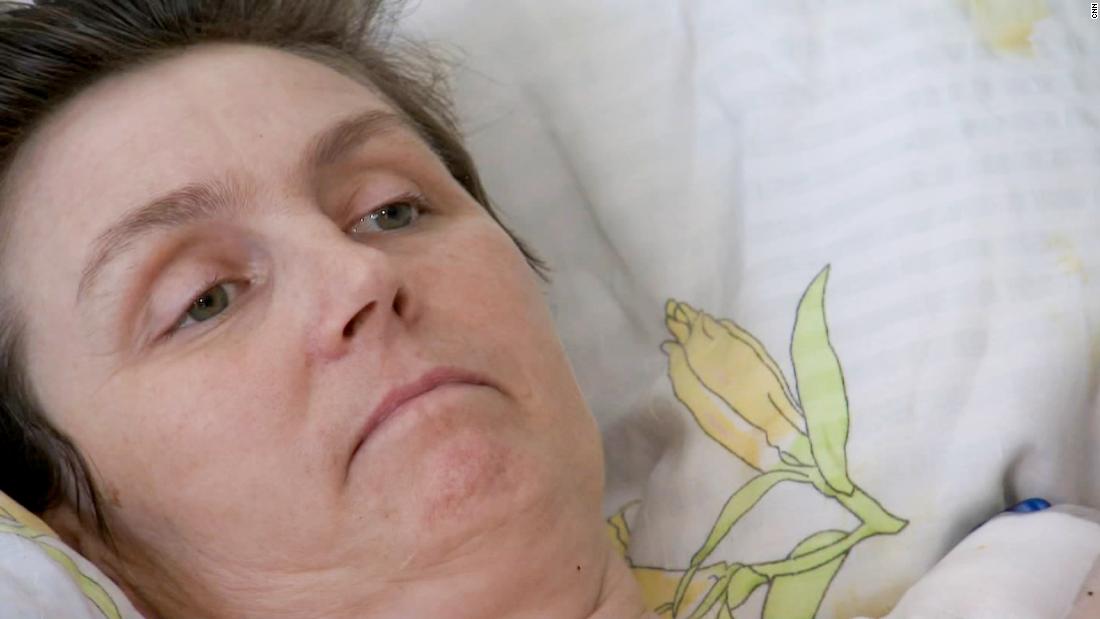 Video: Wounded Ukrainian woman speaks to CNN after 7 bombs hit her neighborhood – CNN Video
