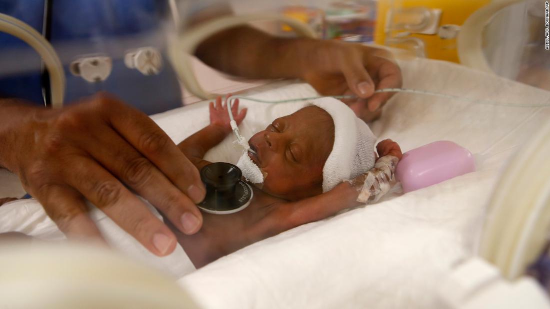 Nonuplets, geboren von einem malischen Paar, das seinen ersten Geburtstag feiert