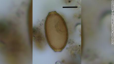 Фекалии древнего человека содержали микроскопические яйца волосатого червя, которые можно было идентифицировать по форме лимона. 