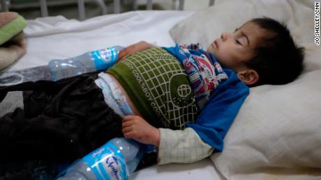 Two-year-old Mohammad lies in a small bed in the malnutrition ward at the Indira Gandhi Children & # 39; s Hospital in Kabul.