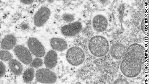 This 2003 electron microscope image made available by the US Centers for Disease Control and Prevention shows mature, oval-shaped monkeypox virions, left, and spherical immature virions, right, obtained from a sample of human skin associated with the 2003 prairie dog outbreak.