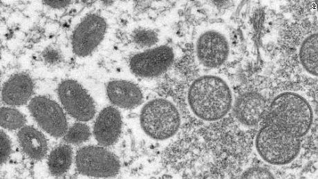 Nenhuma transmissão aérea do vírus da varíola dos macacos foi relatada.  O Centro de Controle de Doenças diz