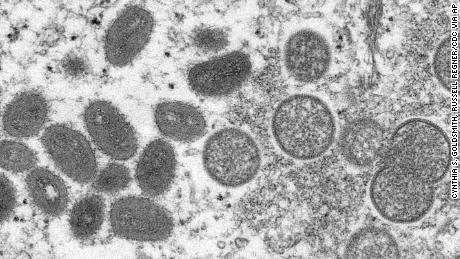 Bir insan derisi örneğinden elde edilen, sağda, olgun, oval şekilli maymun çiçeği viryonlarının (sol ve küresel olgunlaşmamış viryonların) bir mikroskop görüntüsü. 