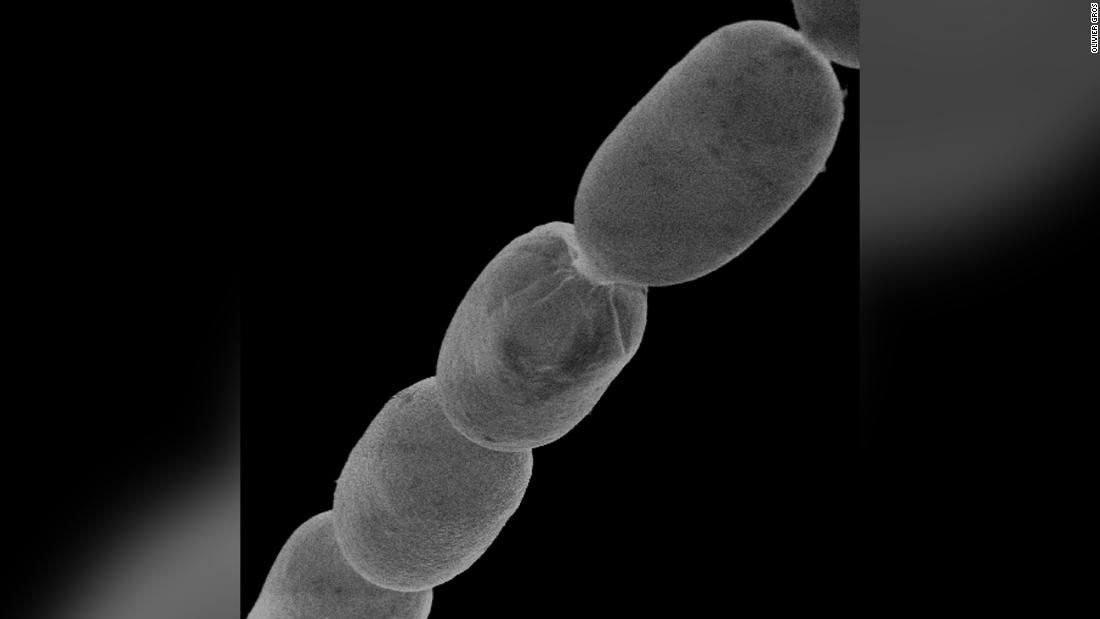 World's largest bacterium discovered is the size of a human eyelash - CNN