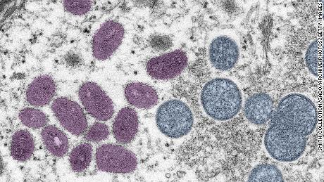 CDC mengaktifkan pusat operasi darurat monkeypox
