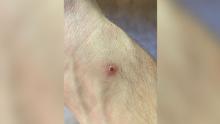 Matt Ford said he had more than 25 injuries on his body, like this one on his arm.