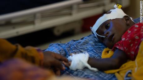 Fatima Abdullahi estende a mão para tocar sua filha Abdi, de 8 meses, hospitalizada por desnutrição grave na Somália em julho.