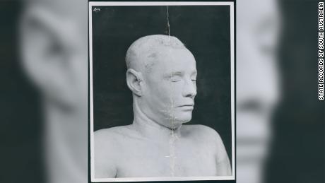 A plaster cast was made of the Somerton man&#39;s face when efforts to discover his identity failed.