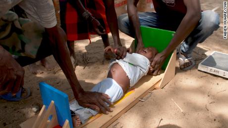 طفل يعاني من سوء التغذية يجري قياسه في إيلريت ، شمال كينيا.
